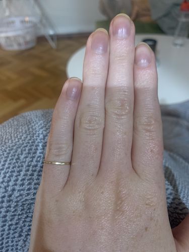 Customer photo review of Ring Sizer (free domestic shipping)
