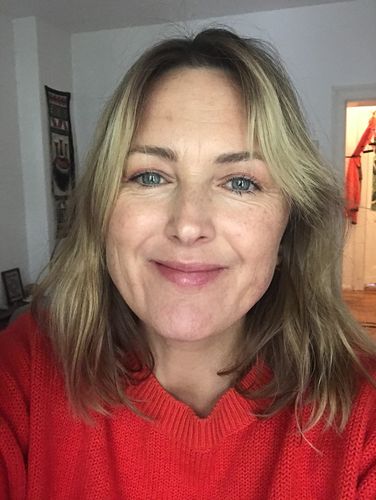 Customer photo review of Anti-Wrinkle Patches (All-in-one)