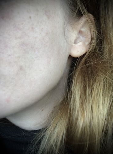 Customer photo review of Niacid