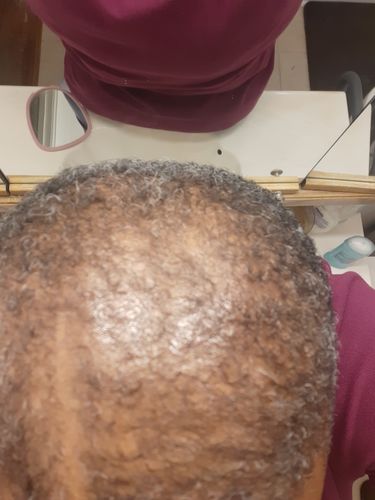 Customer photo review of PureFix Hair Elixir