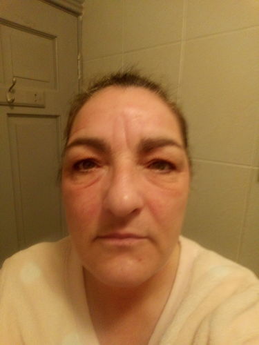 oia skin reviews trustpilot