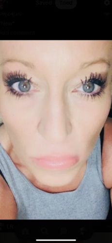 Customer photo review of Anti-Wrinkle Patches for Face Lift