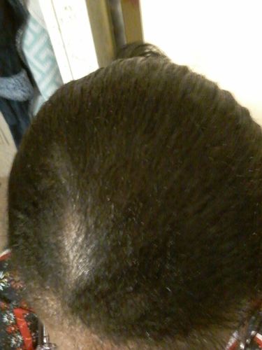 Customer photo review of PureFix Hair Elixir