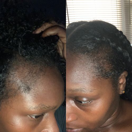 Customer photo review of Chad and India’s Root to Tip Bundle BACK IN STOCK. FREE SHIPPING