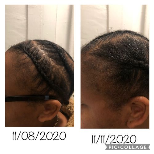 Customer photo review of Inches - Hair & Beard Growth Oil