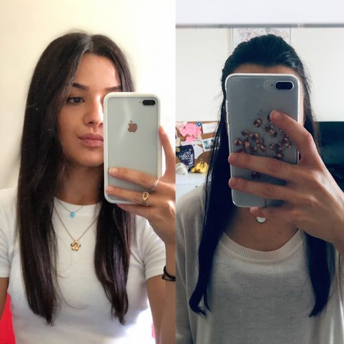 Customer photo review of In Haircare - Cure pousse de cheveux 1 mois