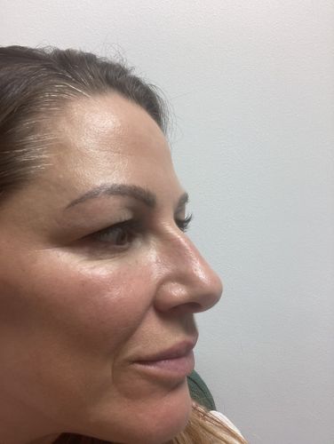 Customer photo review of Sapphire Magnetic Eyelashes and Eyeliner Kit