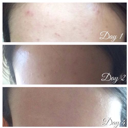 undefined review of NeoStrata Gel Plus AHA15 image 1 out of 1