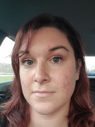 Customer photo review of Dreamlike Blue Prescription Contact Lenses