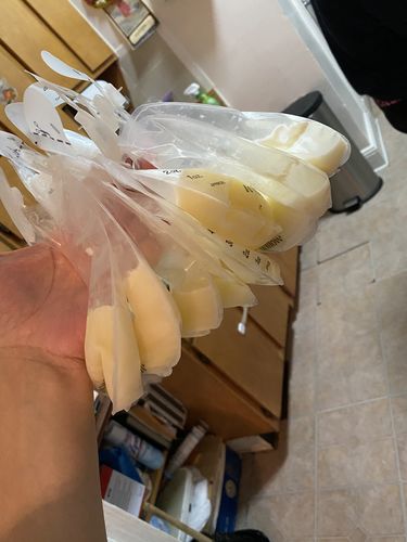 Customer photo review of Willow Generation 3, 24 mm