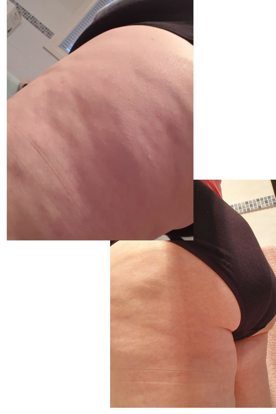 Customer photo review of FibreCel™ Shorts