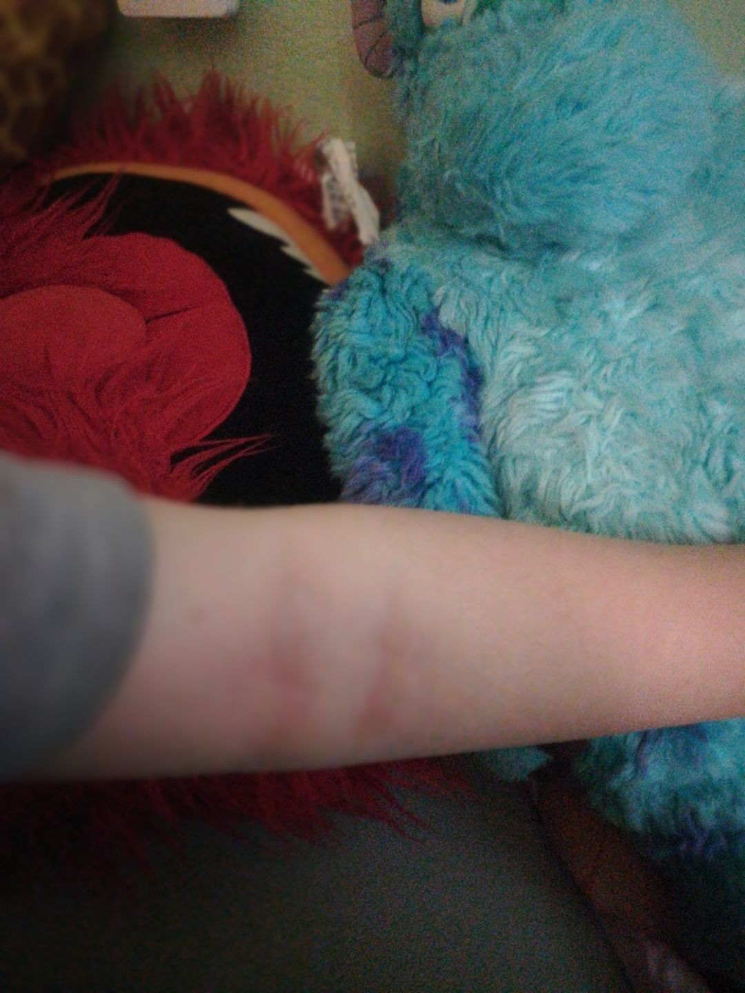 Customer photo review of Bioskin DermaSpray Intensive 15.00% Off Auto renew