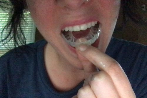 Customer photo review of Night Guard