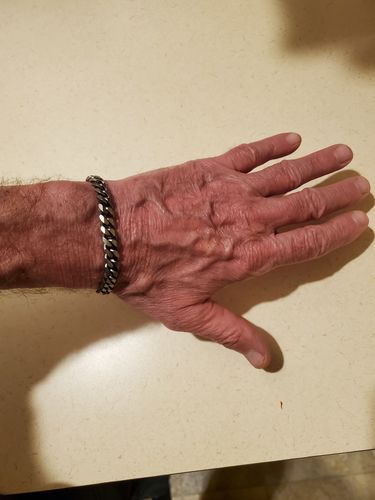 Customer photo review of 8mm Antiqued Steel Matte Cuban Link Bracelet