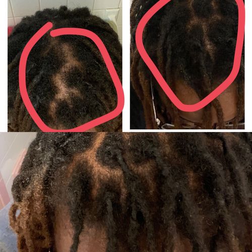 Customer photo review of Hair Growth Serum | 1 oz