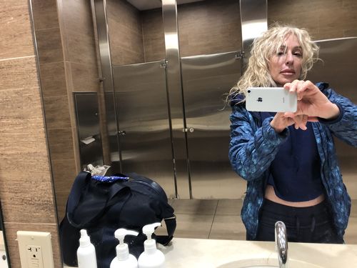 Customer photo review of WrinkleFix: Botox Membership