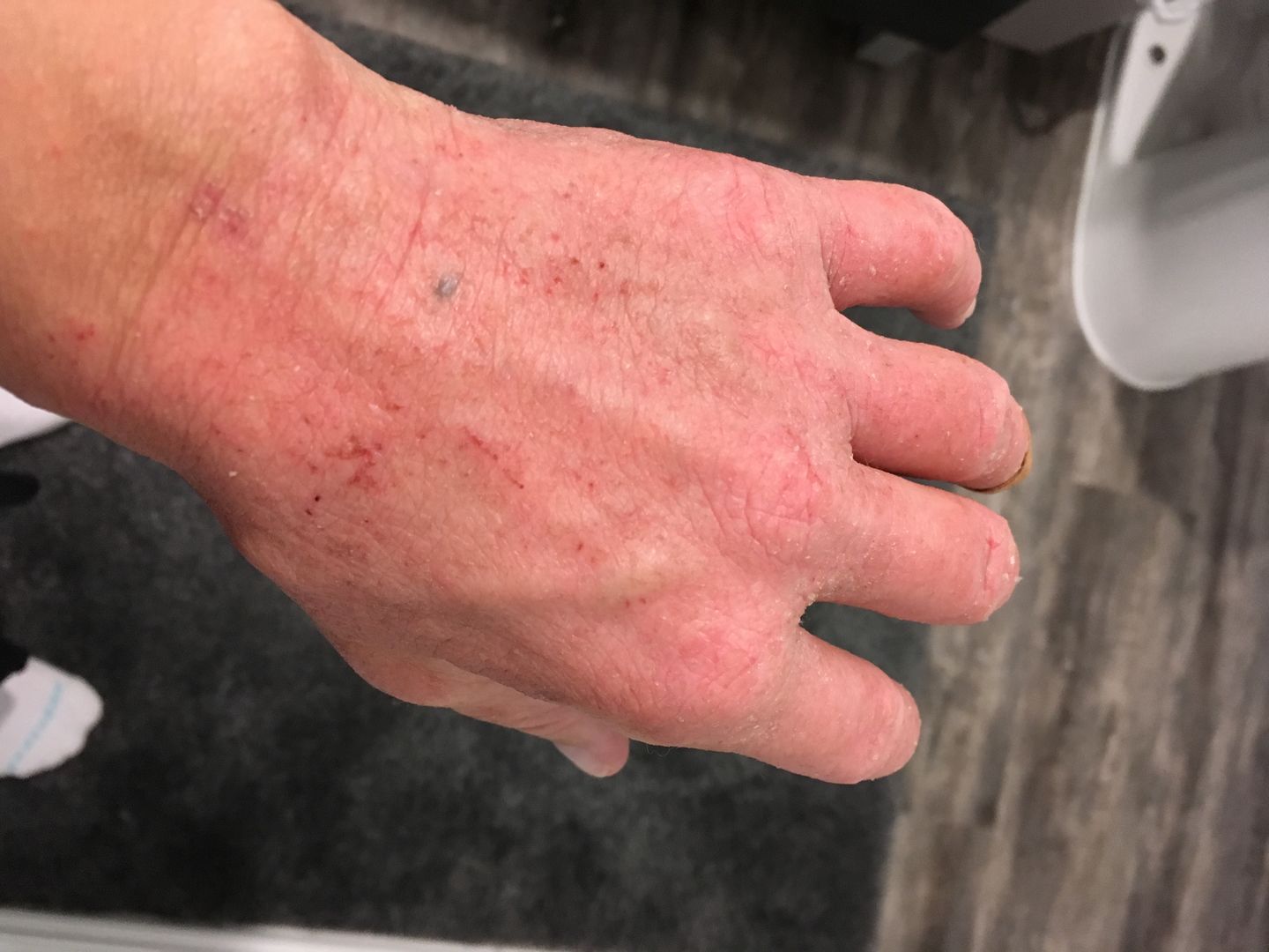 Customer photo review of Combat Ready Ointment - Mother of All Bottles (MOAB)