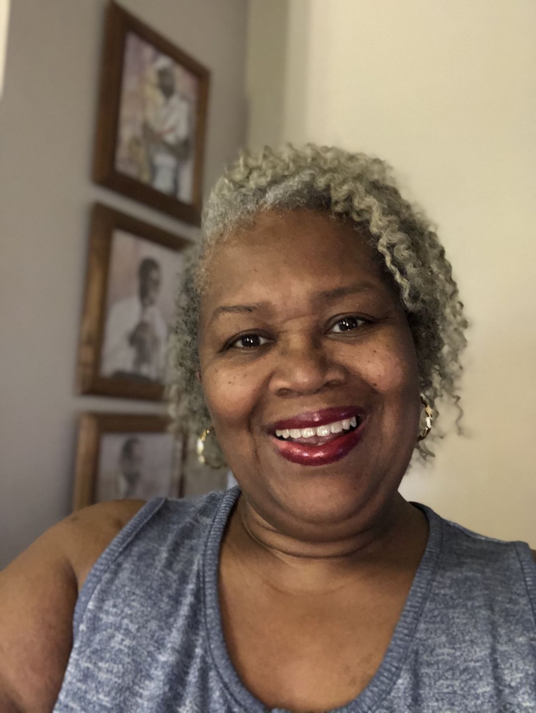 Customer photo review of Moisturizing Cream (12oz)