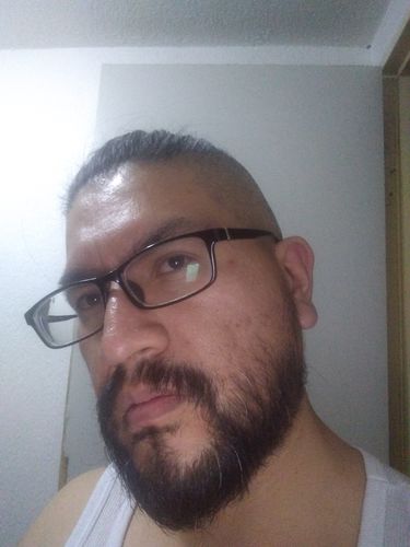Porque No Me Crece Barba En Las Mejillas