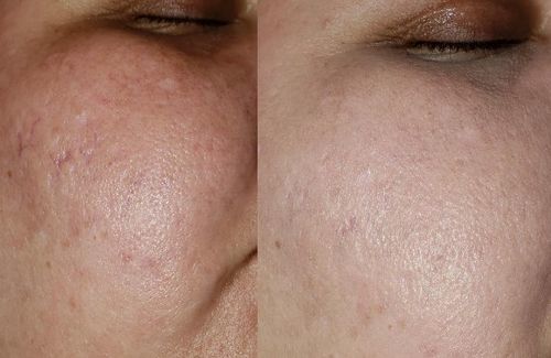 Customer photo review of Pore Concealer Primer