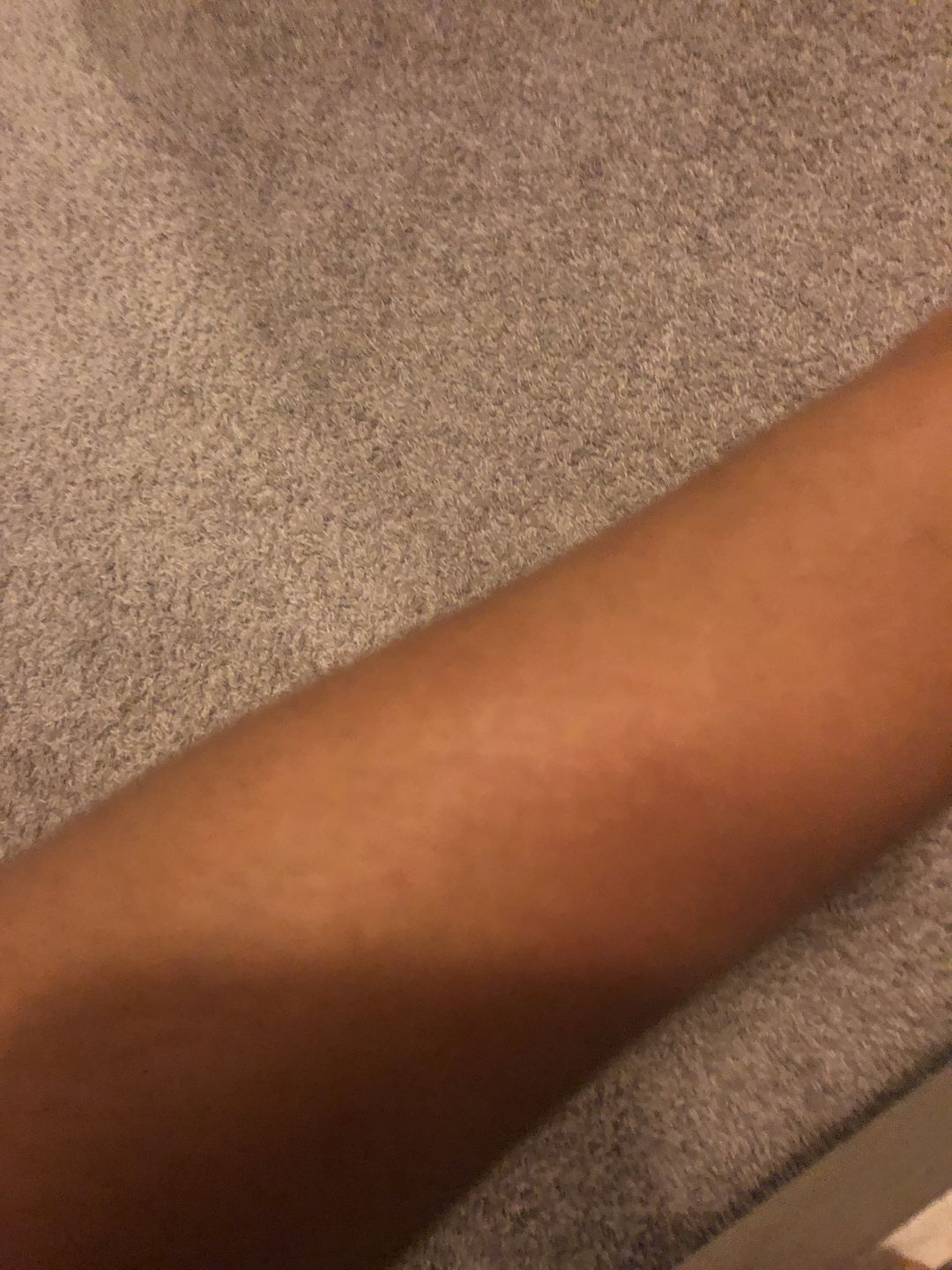 Customer photo review of Omic LightenUp Anti-Aging Lightening Body Lotion - 400ml
