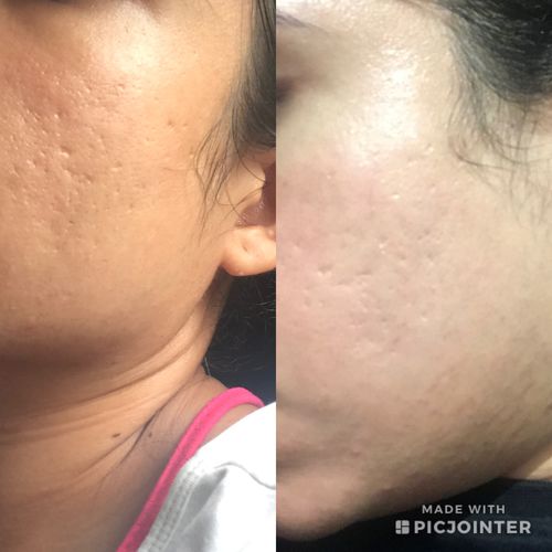 Customer photo review of Niacid