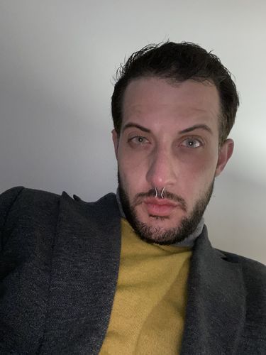 Customer photo review of Quartz Prescription Colored Contact Lenses