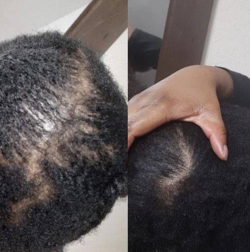 Customer photo review of Inches - Hair & Beard Growth Oil