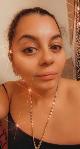 Customer photo review of Mel Prescription Contact Lenses