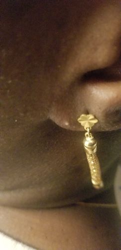 Customer photo review of Simple Spectrum Nutritional Support Supplement