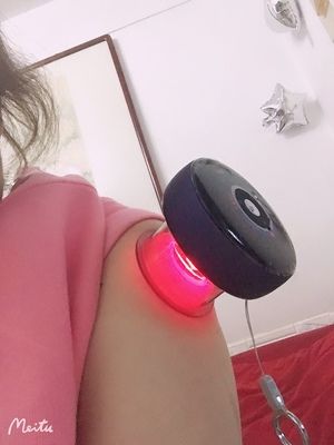 Customer photo review of FITDASH™-II 5th Gen Cupping Moxa Therapy Device