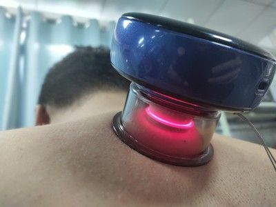 Customer photo review of FITDASH™-II 5th Gen Cupping Moxa Therapy Device