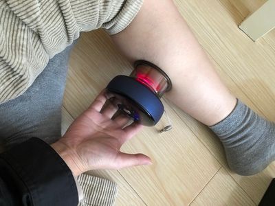Customer photo review of FITDASH™-II 5th Gen Cupping Moxa Therapy Device