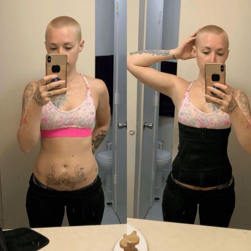 Customer photo review of SWEETFIT™: Adjustable Waist Slimming Trimmer.