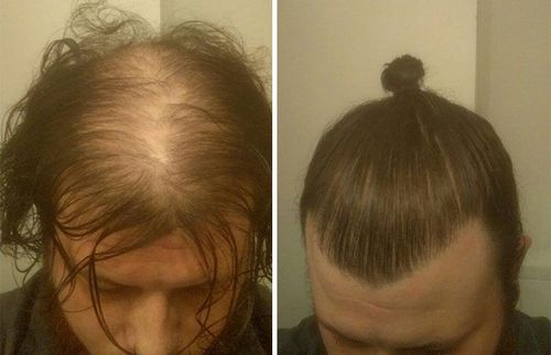 Customer photo review of KIT REPOUSSE CHEVEUX