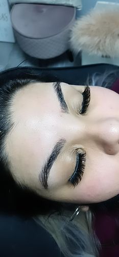 Customer photo review of MesoFirm Serum