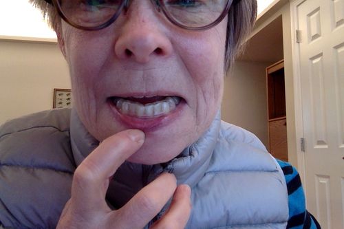 Customer photo review of Night Guard