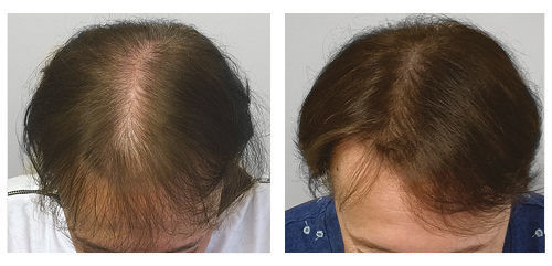 Customer photo review of KIT REPOUSSE CHEVEUX