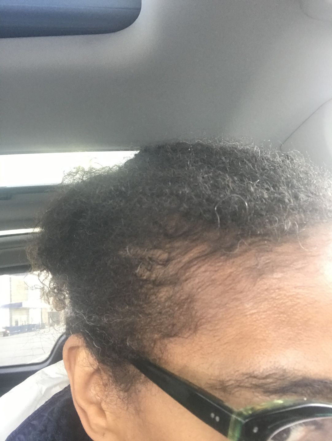 Customer photo review of Miracle 3-n-1 Clay Wash