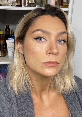 Customer photo review of [US Warehouse] Cherry Honolulu Contact Lenses