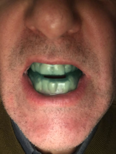 Customer photo review of SleepPro Custom AM