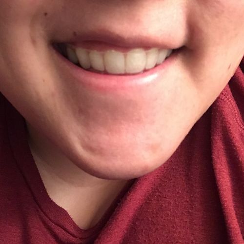 Customer photo review of Night Guard