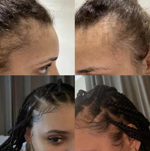 Customer photo review of Inches - Hair & Beard Growth Oil