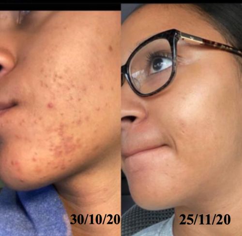 Customer photo review of Ziegenmilch Bio-Masken-Seife TEINT PRÉCIEUX von MaggyBeauty