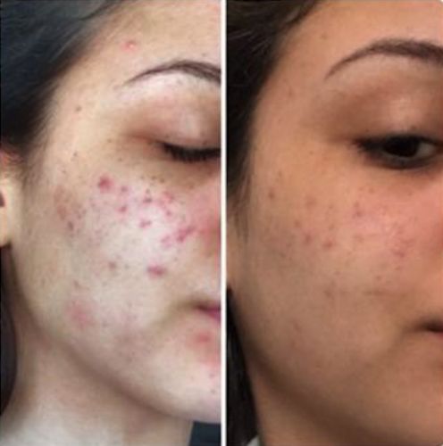 Customer photo review of Ziegenmilch Bio-Masken-Seife TEINT PRÉCIEUX von MaggyBeauty