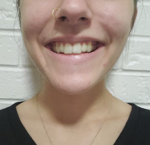 Customer photo review of Night Guard