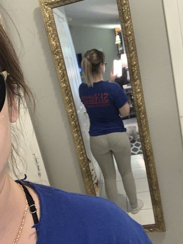 Customer photo review of GYMKARTEL® ANTI-CELLULITE AND PUSH UP LEGGINGS - WHITE