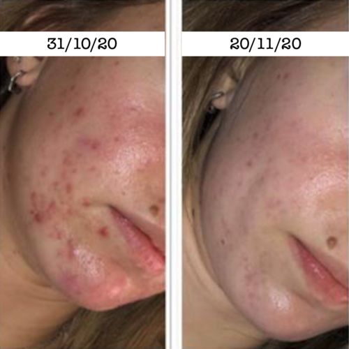 Customer photo review of Ziegenmilch Bio-Masken-Seife TEINT PRÉCIEUX von MaggyBeauty
