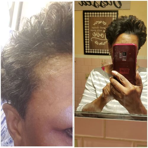 Customer photo review of PureFix Hair Elixir