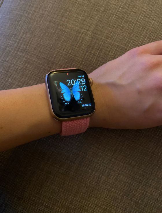 Customer photo review of Nylon Braided Solo Loop Band for Apple Watch